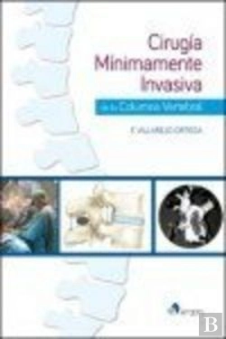 Bertrand.pt - Cirugía Mínimamente Invasiva De La Columna Vertebral