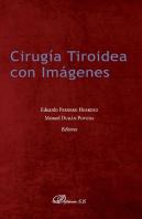 Cirugía Tiroidea Con Imágenes