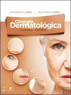 Bertrand.pt - Cirurgia Dermatológica