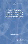 Clarkâ€™S Essential Guide To Preliminary Clinical Evaluation Of Musculoskeletal X-Rays