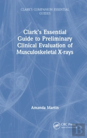 Clarkâ€™S Essential Guide To Preliminary Clinical Evaluation Of Musculoskeletal X-Rays
