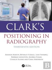 Clark'S Positioning In Radiography