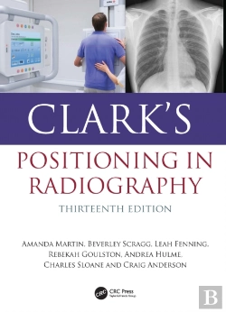Bertrand.pt - Clark'S Positioning In Radiography