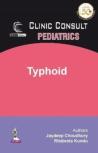 Clinic Consult Pediatrics: Typhoid