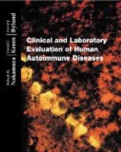 Bertrand.pt - Clinical And Laboratory Evaluation Of Human Autoimmune Diseases