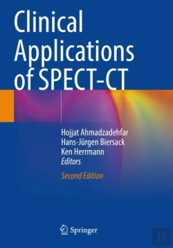Bertrand.pt - Clinical Applications Of Spect-Ct