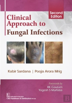 Bertrand.pt - Clinical Approach To Fungal Infections