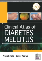 Clinical Atlas Of Diabetes Mellitus