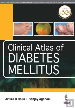 Bertrand.pt - Clinical Atlas Of Diabetes Mellitus