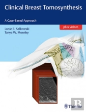 Clinical Breast Tomosynthesis
