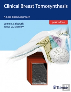 Bertrand.pt - Clinical Breast Tomosynthesis