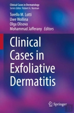 Bertrand.pt - Clinical Cases In Exfoliative Dermatitis