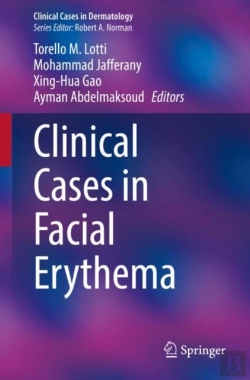Bertrand.pt - Clinical Cases In Facial Erythema