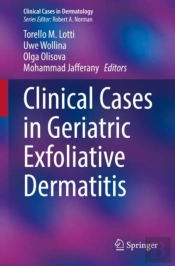Clinical Cases In Geriatric Exfoliative Dermatitis