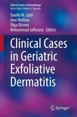 Bertrand.pt - Clinical Cases In Geriatric Exfoliative Dermatitis