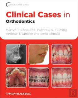 Bertrand.pt - Clinical Cases In Orthodontics