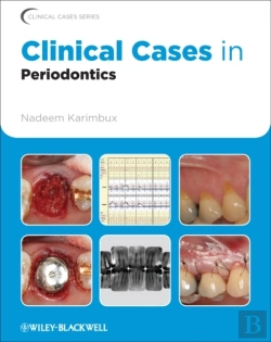 Bertrand.pt - Clinical Cases In Periodontics