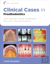 Clinical Cases In Prosthodontics