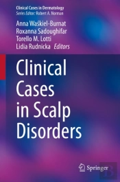 Clinical Cases In Scalp Disorders