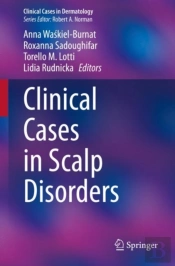 Clinical Cases In Scalp Disorders