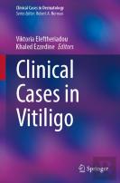 Clinical Cases In Vitiligo