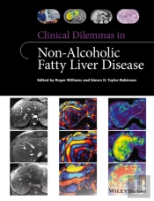 Clinical Dilemmas In Non-Alcoholic Fatty Liver Disease