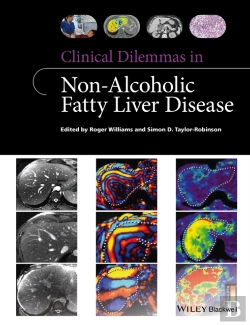 Bertrand.pt - Clinical Dilemmas In Non-Alcoholic Fatty Liver Disease