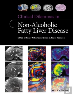 Bertrand.pt - Clinical Dilemmas In Non-Alcoholic Fatty Liver Disease