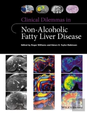 Clinical Dilemmas In Non-Alcoholic Fatty Liver Disease