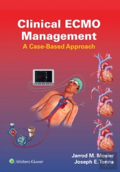 Clinical Ecmo Management