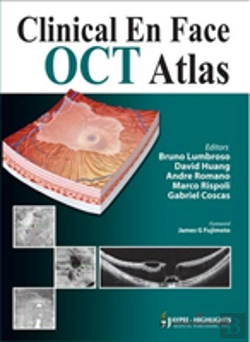 Bertrand.pt - Clinical En Face Oct Atlas