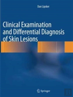 Bertrand.pt - Clinical Examination And Differential Diagnosis Of Skin Lesions