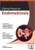 Clinical Focus On Endometriosis