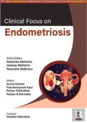 Clinical Focus On Endometriosis