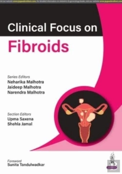 Bertrand.pt - Clinical Focus On Fibroids