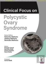 Clinical Focus On Polycystic Ovary Syndrome