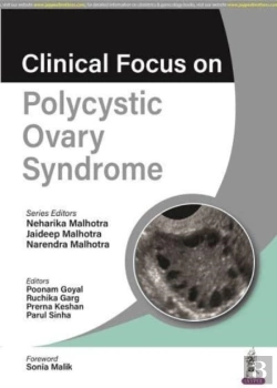 Bertrand.pt - Clinical Focus On Polycystic Ovary Syndrome
