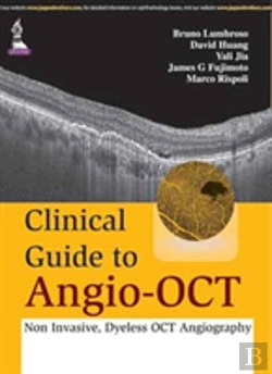 Bertrand.pt - Clinical Guide To Angio-Oct: Non Invasive, Dyeless Oct Angiography