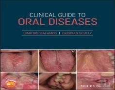 Clinical Guide To Oral Diseases