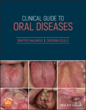 Clinical Guide To Oral Diseases