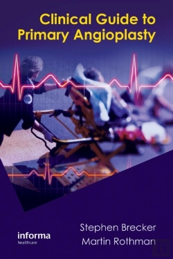 Bertrand.pt - Clinical Guide To Primary Angioplasty