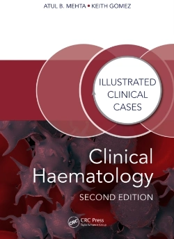 Bertrand.pt - Clinical Haematology