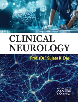 Bertrand.pt - Clinical Neurology
