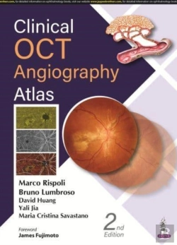 Bertrand.pt - Clinical Oct Angiography Atlas