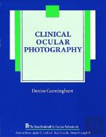 Clinical Ocular Photography