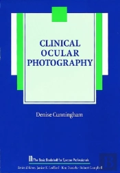 Clinical Ocular Photography