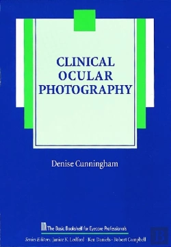 Bertrand.pt - Clinical Ocular Photography