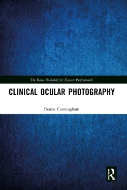 Bertrand.pt - Clinical Ocular Photography