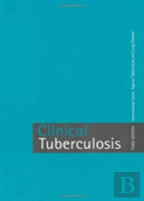 Clinical Tuberculosis