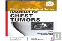 Clinico Radiological Series: Imaging Of Chest Tumors